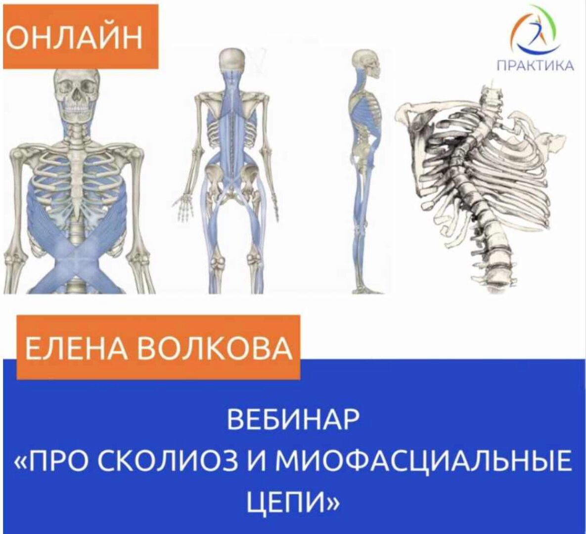 Про сколиоз и миофасциальные цепи (Елена Волкова)