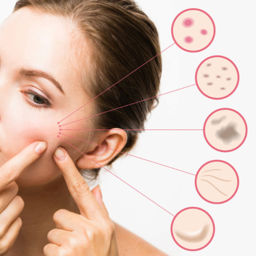 Здоровая кожа (Тимофей Кармацкий)