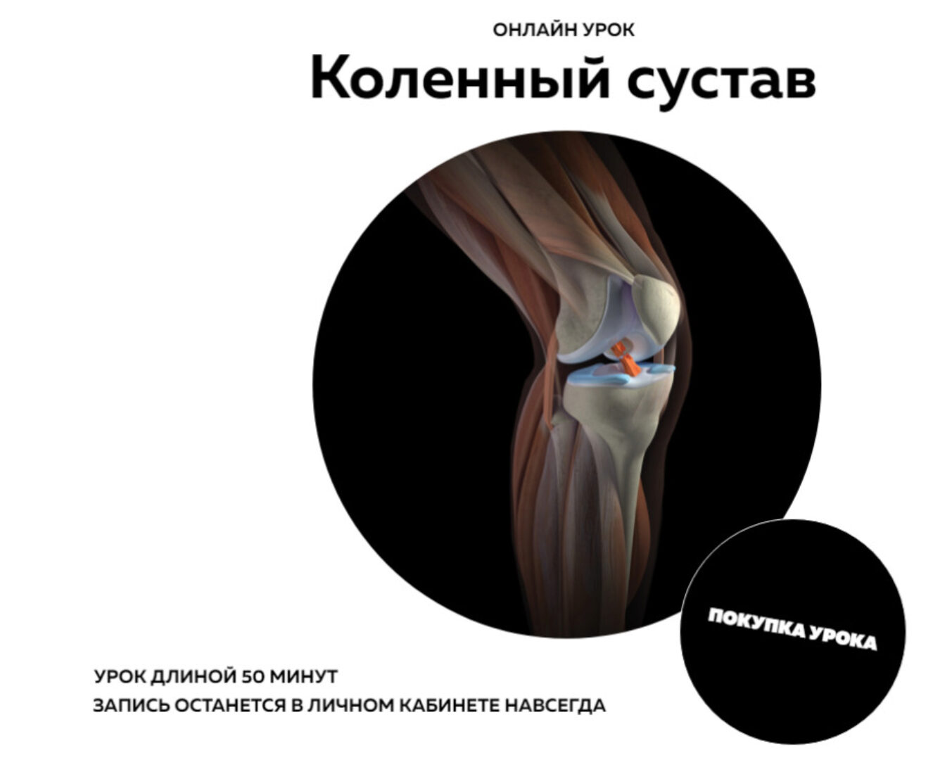 [NL-School] Коленный сустав (Кирилл Копыльцов)