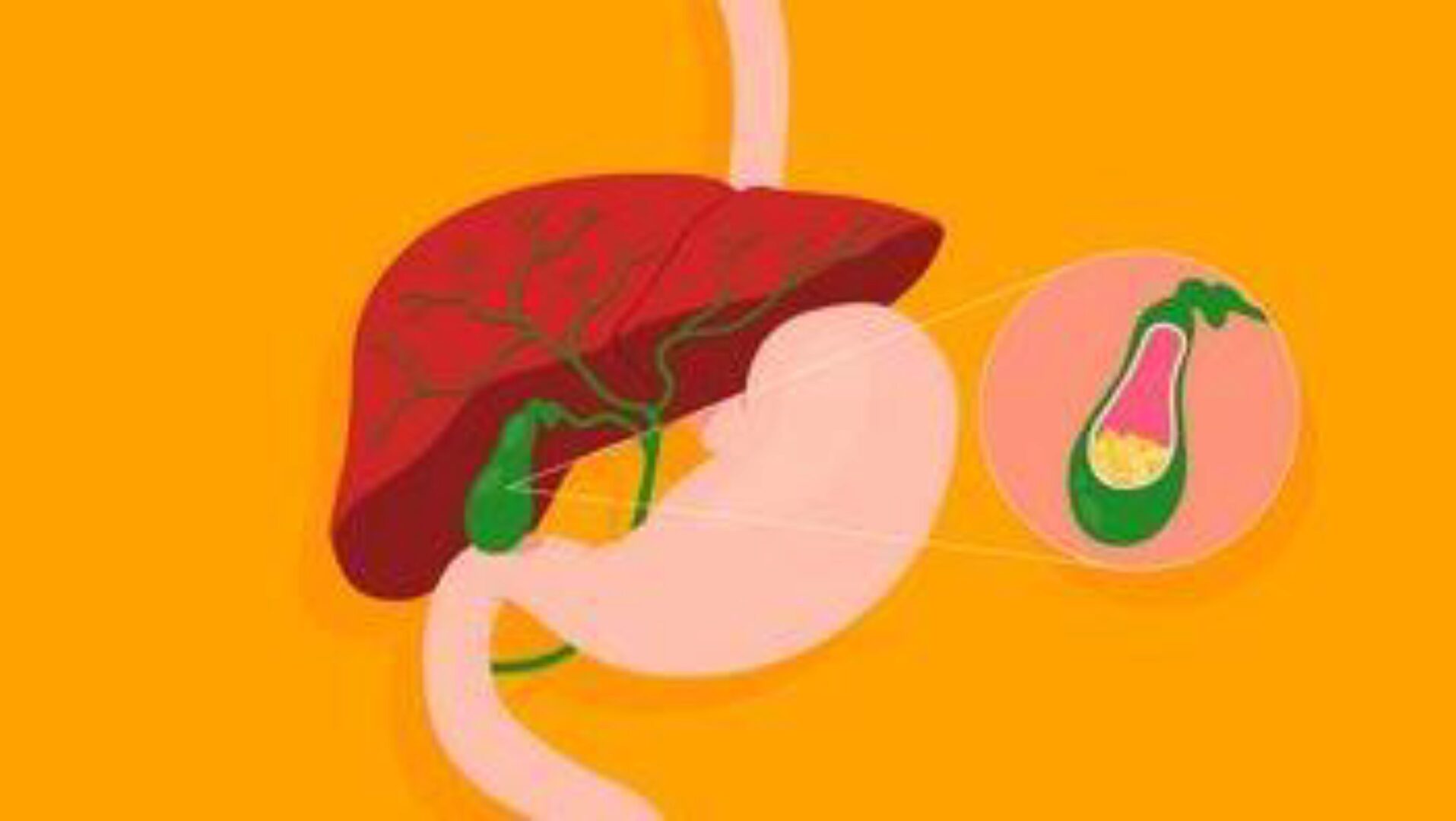 Желчный пузырь. Детоксикация (Галина Гарбузова)