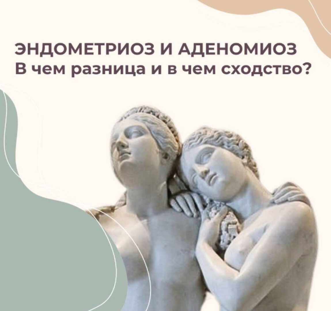 Эндометриоз (Элисо Джобава)