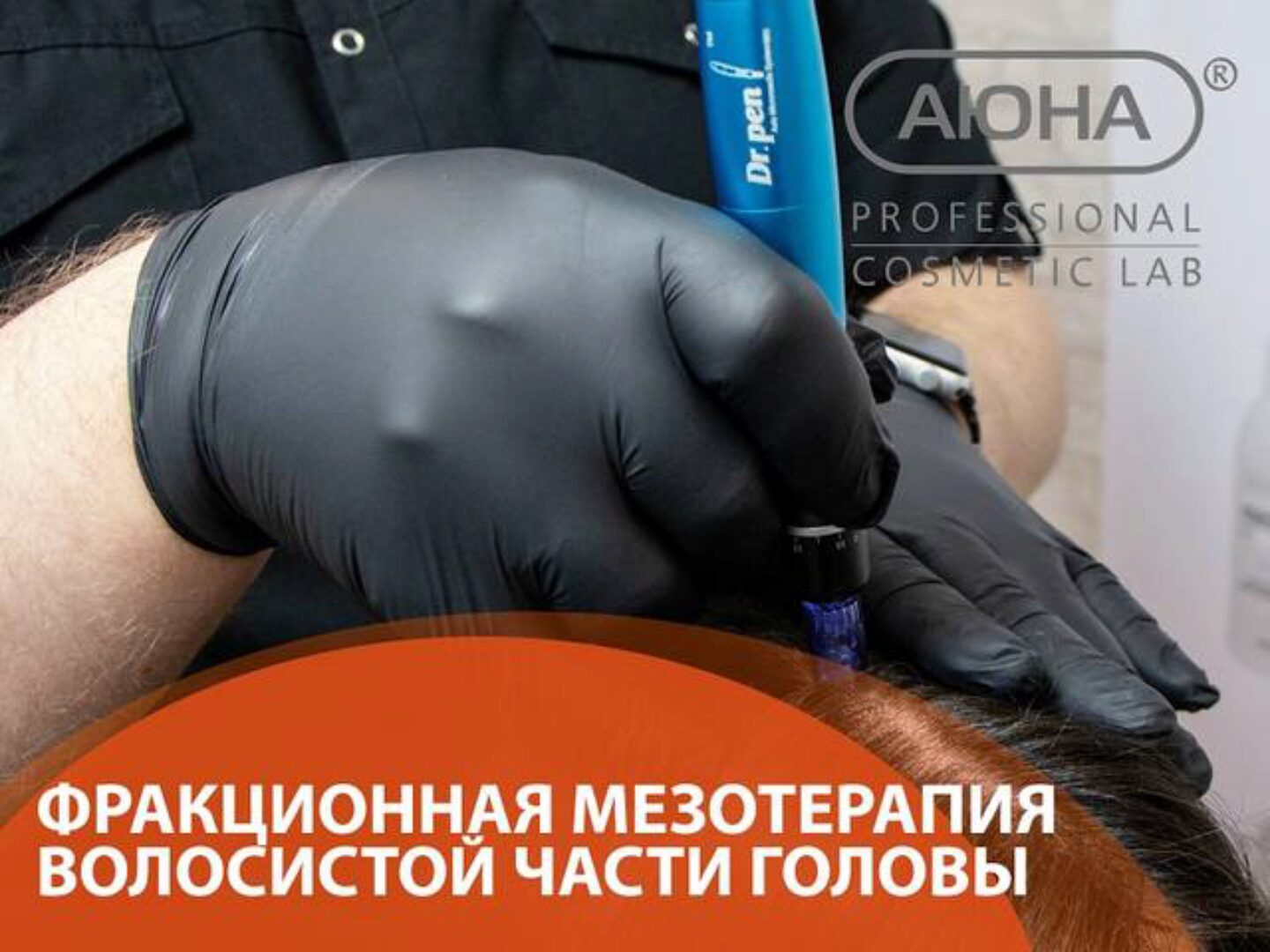 [Аюна] Фракционная мезотерапия волосистой части головы (Романис Ботин–Маевски)