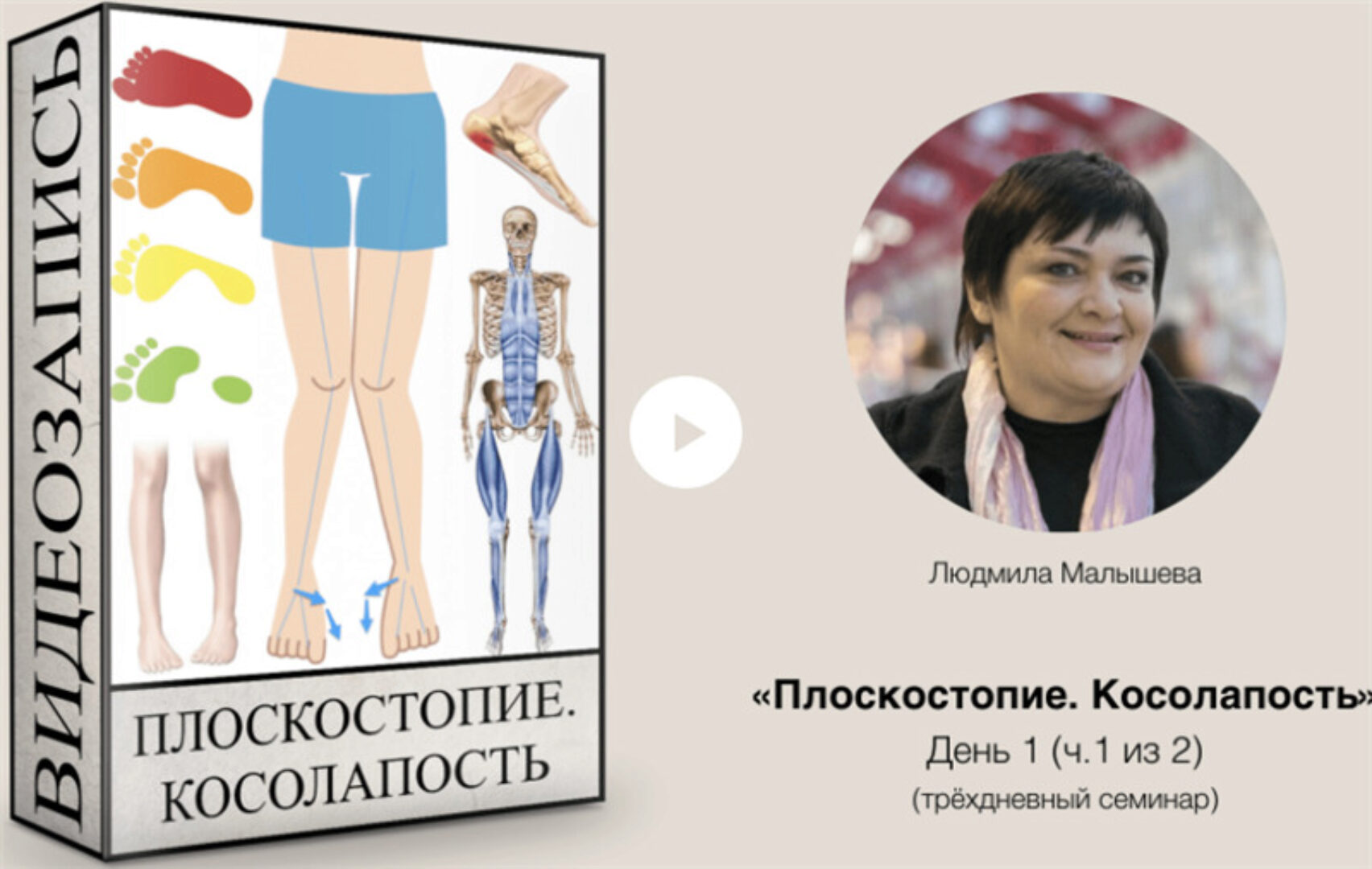 Плоскостопие. Косолапость (Людмила Малышева)