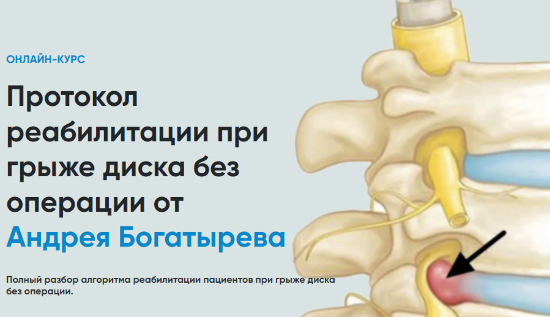 [Rehab Science] Протокол реабилитации при грыже диска без операции (Андрей Богатырев)