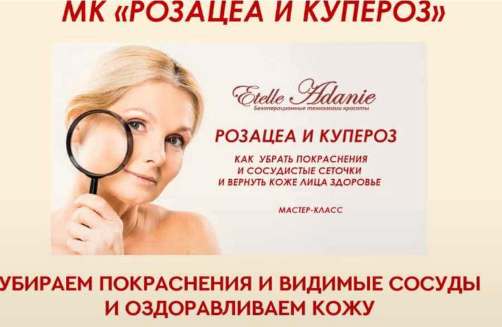 Розацеа и Купероз. Тариф - Розацеа + Купероз (Этель Аданье)