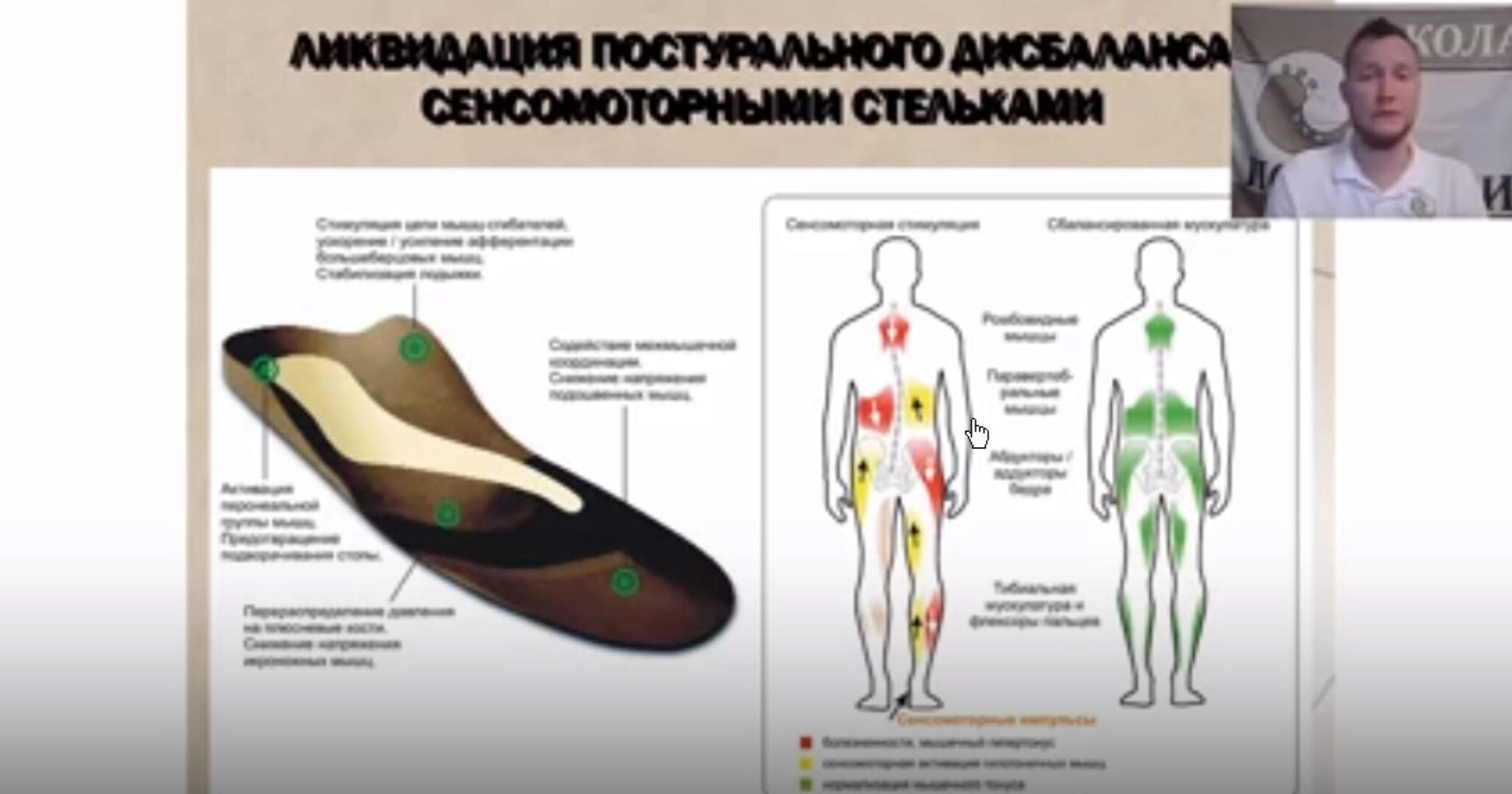 ЛФК при вальгусе. Ортопедические стельки (Кирилл Шлыков)