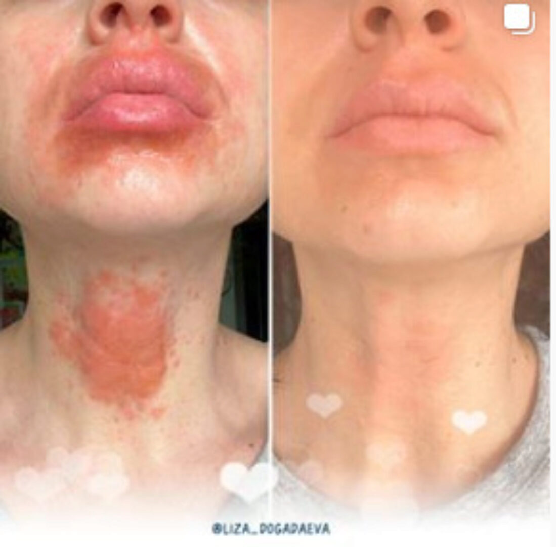 Аллергошкола  2020 (Лиза Догадаева)