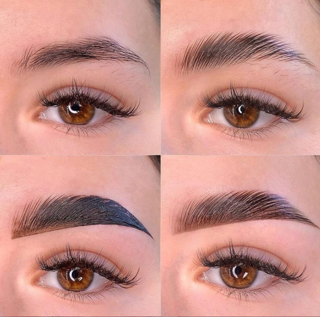 Бронсан. Стандарт (Анастасия Устенко)