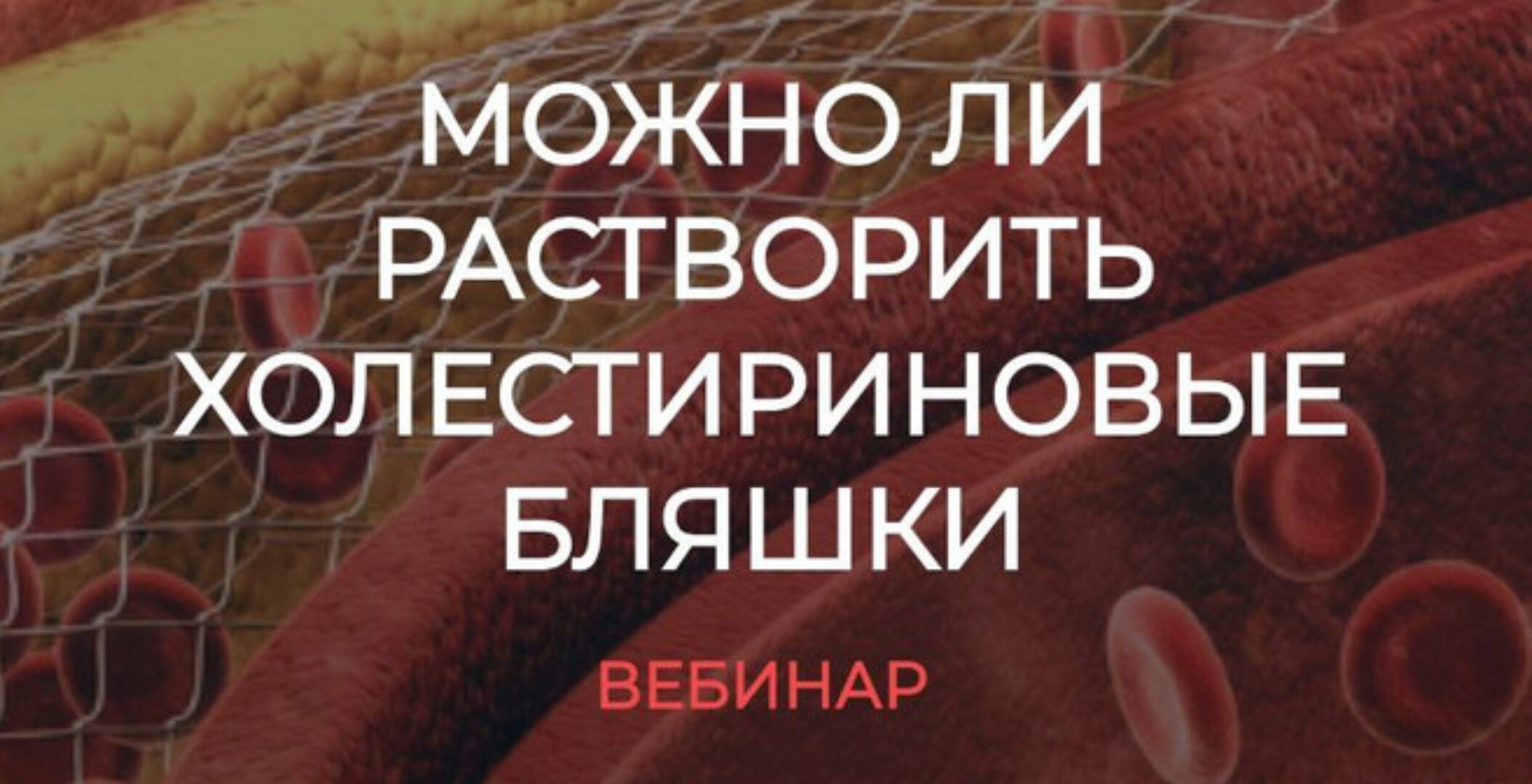 [humberto 2.0] Можно ли растворить холестериновые бляшки (Валерий Подрубаев)