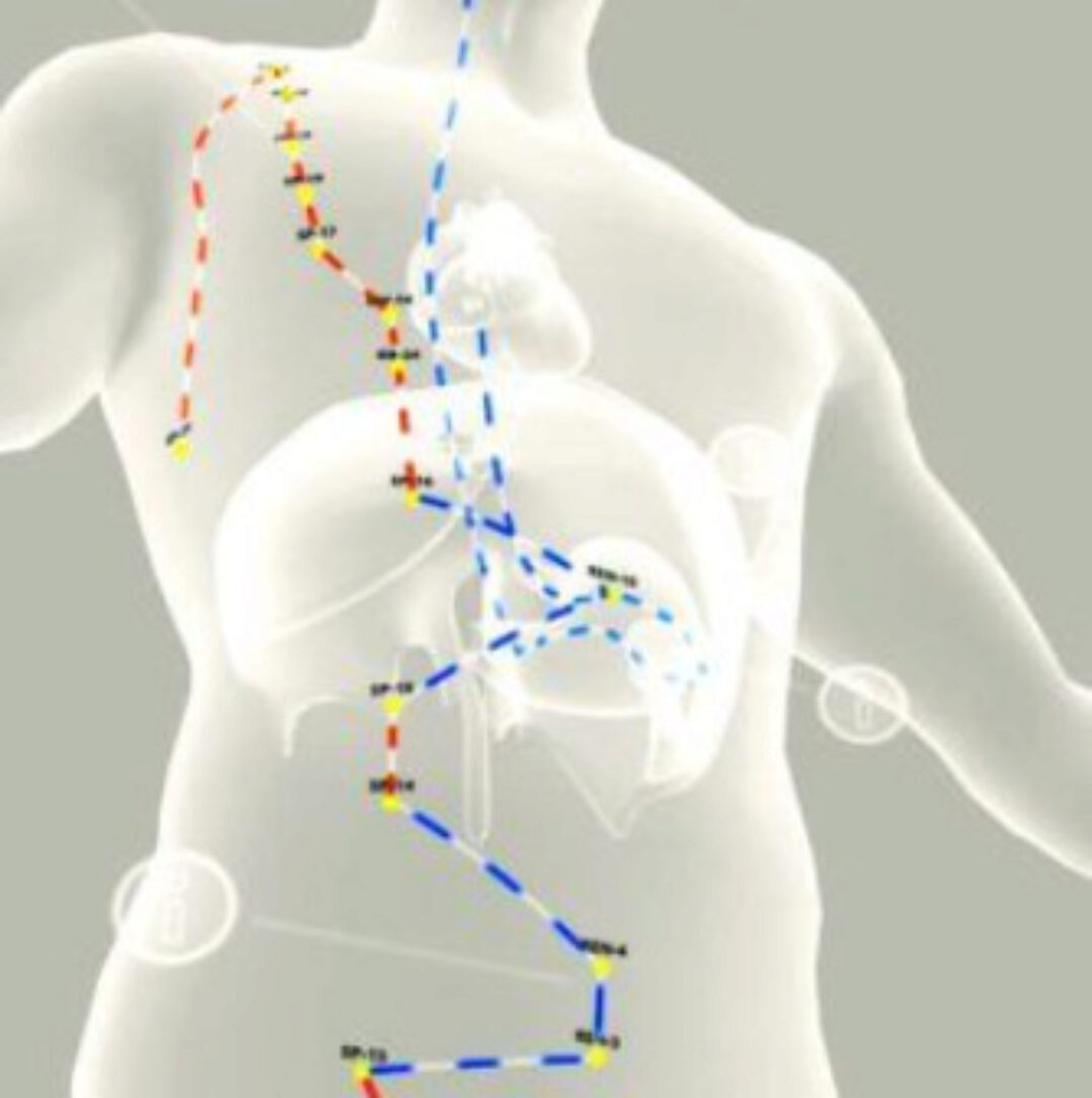 [KBS school] Вебинар. «Дивергентные каналы. Хронические болевые синдромы. Принципы работы. Важные точки» (Евгений Казаков)