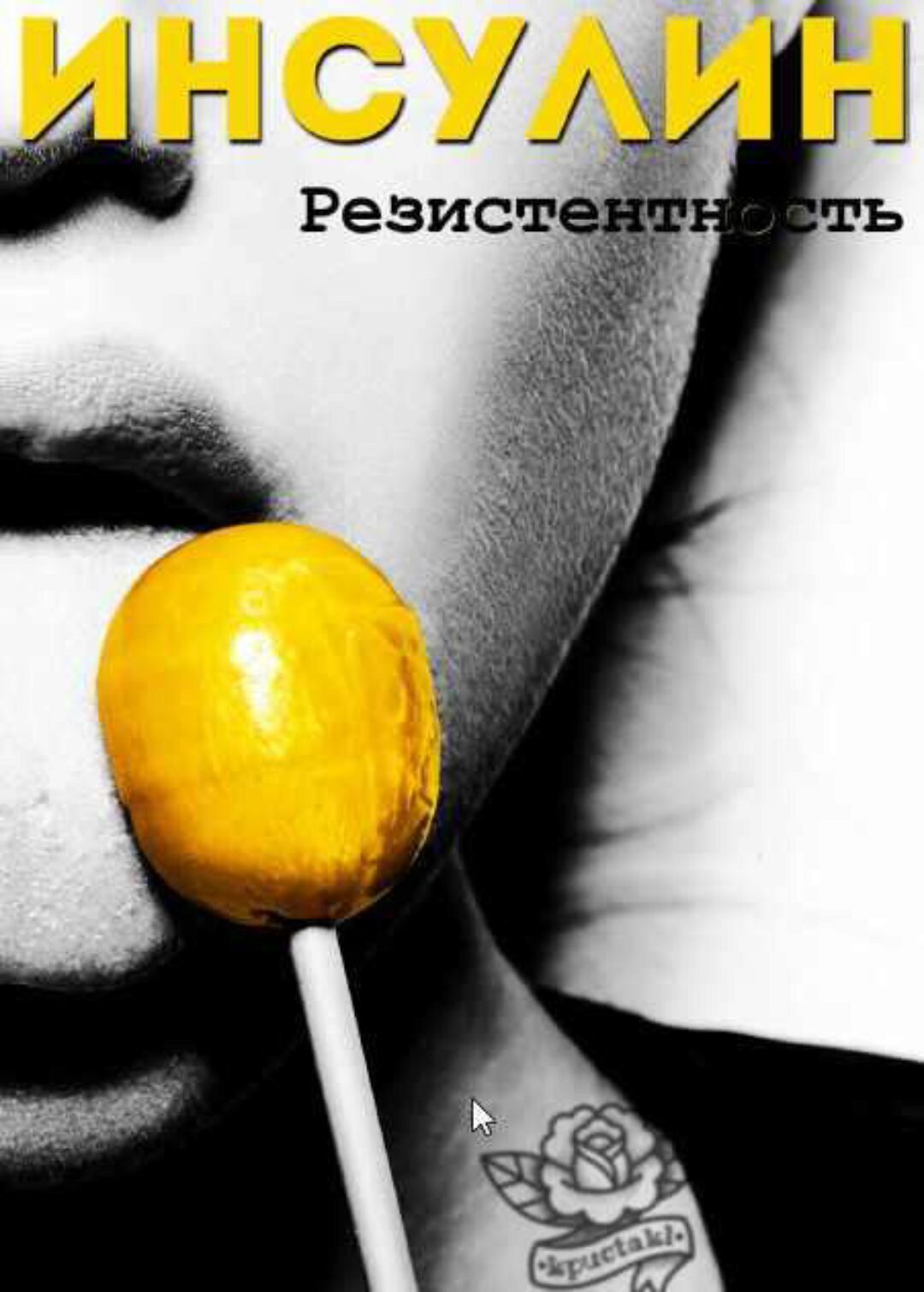 [kpuctakl] Шпаргалка «Исулинорезистентность» (Кристина Трофимова)