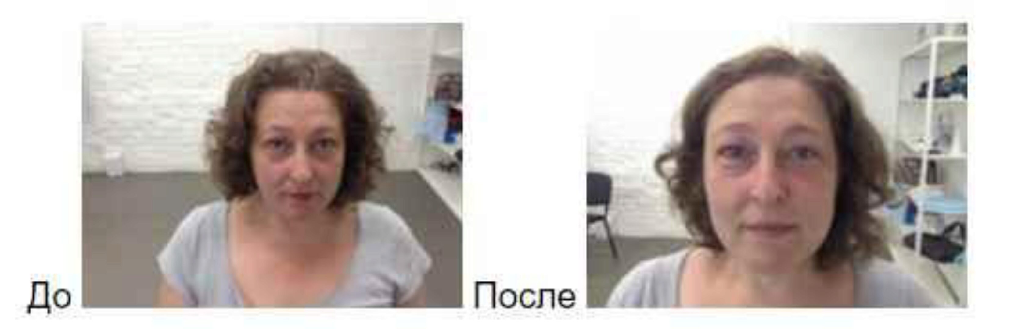 Биомеханика старения лицевых мышц. Самомассаж (Татьяна Шубина)