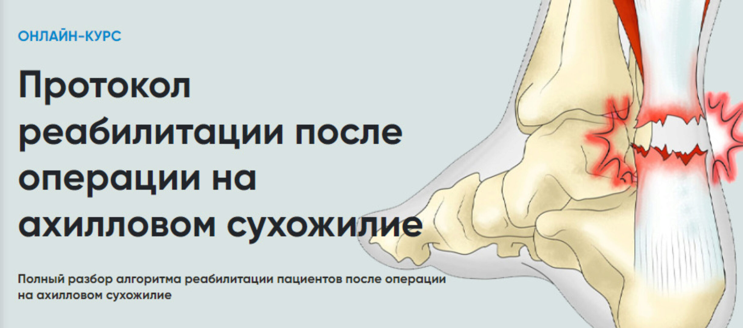 [Rehab Science] Протокол реабилитации после операции на ахилловом сухожилии (Андрей Богатырев)