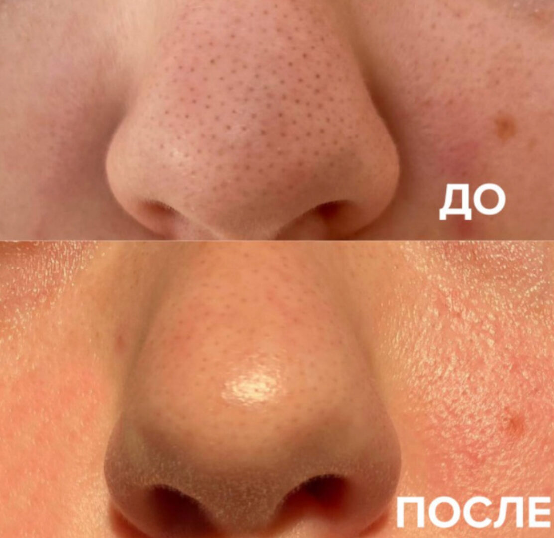 Гайд по чистой коже Blur face (Наталья Bbos)