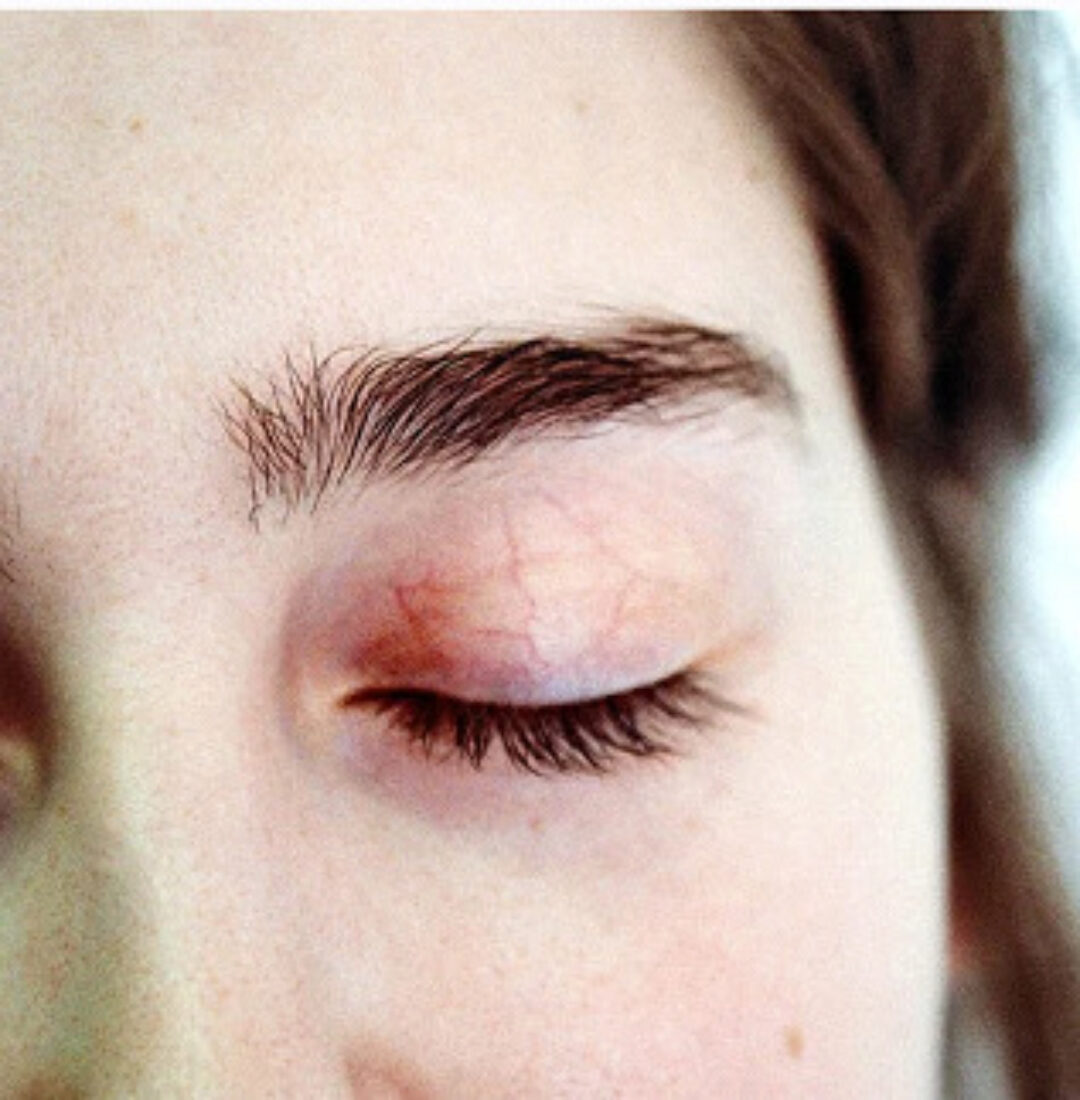 Избавься от анемии (Тимофей Кармацкий)