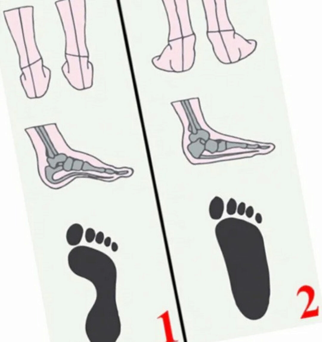 Как убрать плоскостопие за три недели (Елена Кей)