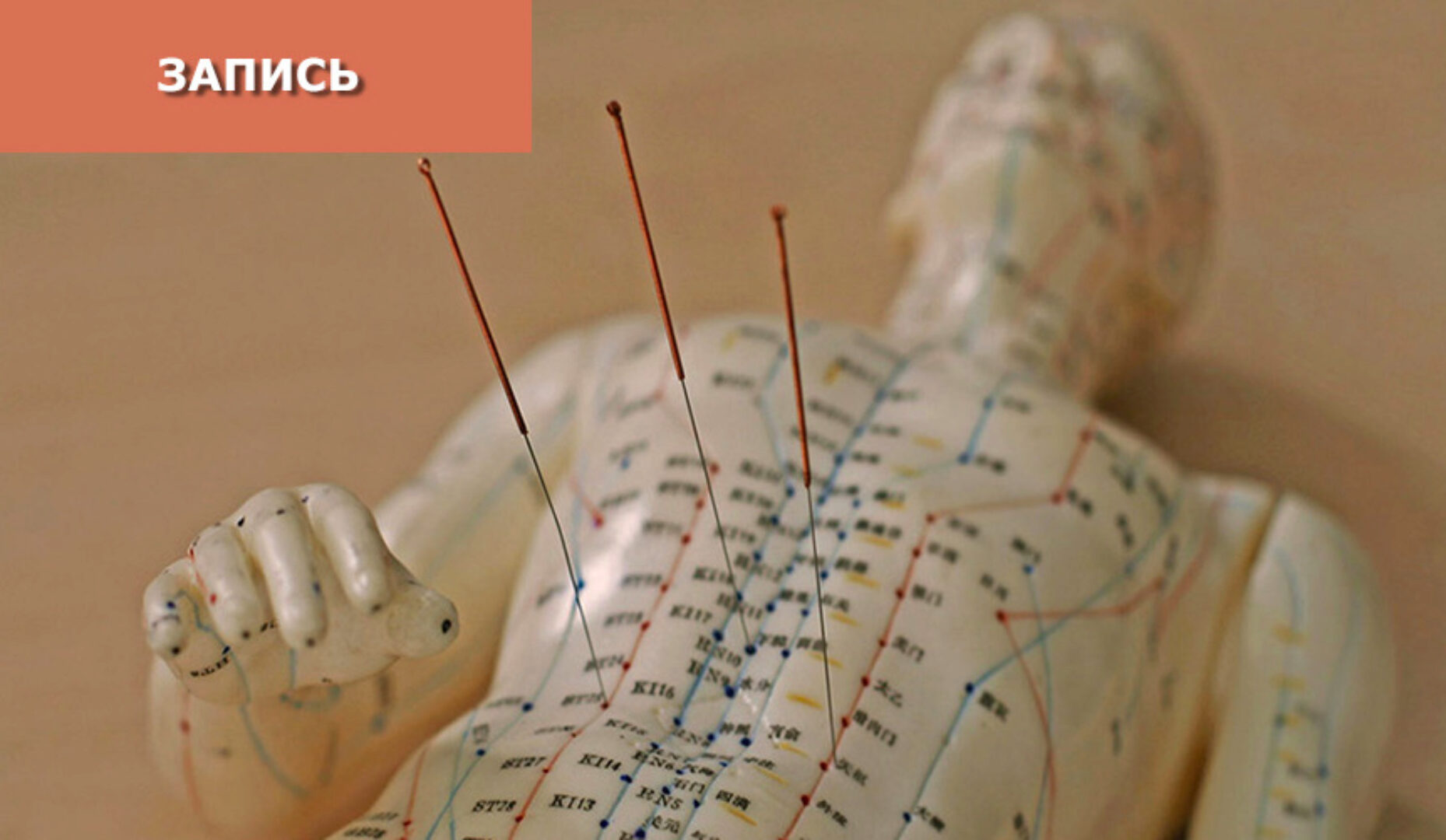 [Синофарм]  Метод трех точек цзинь (Ван Вэй)