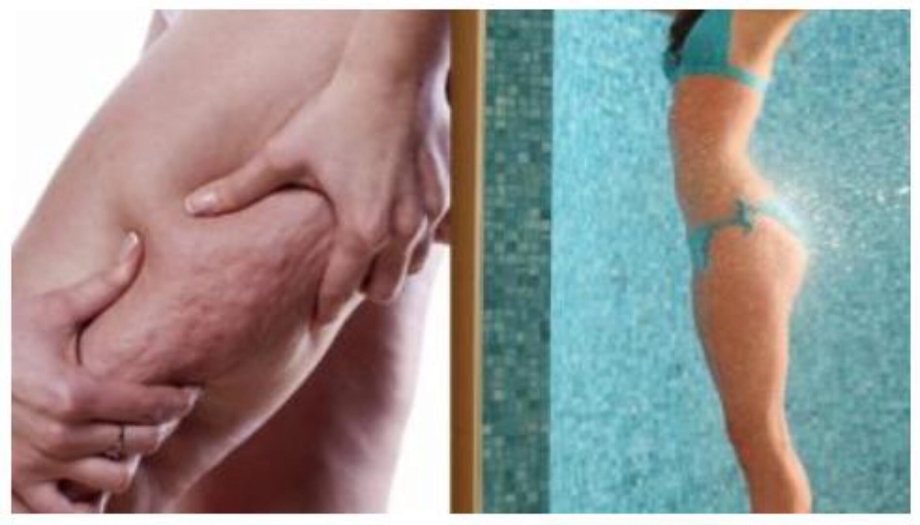 Французский антицеллюлитный массаж (Ольга Шарко)