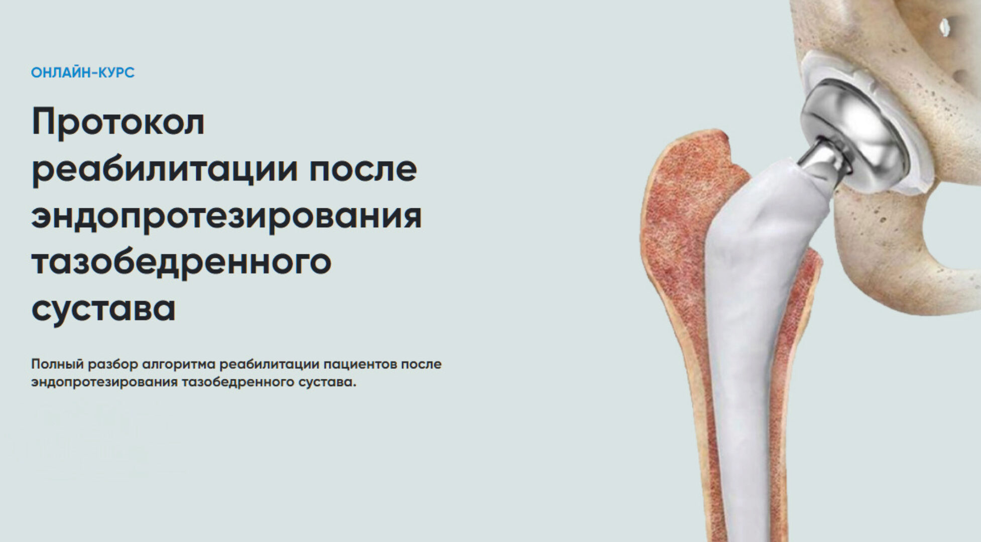 [Rehab Science] Протокол реабилитации после эндопротезирования тазобедренного сустава (Андрей Богатырев)