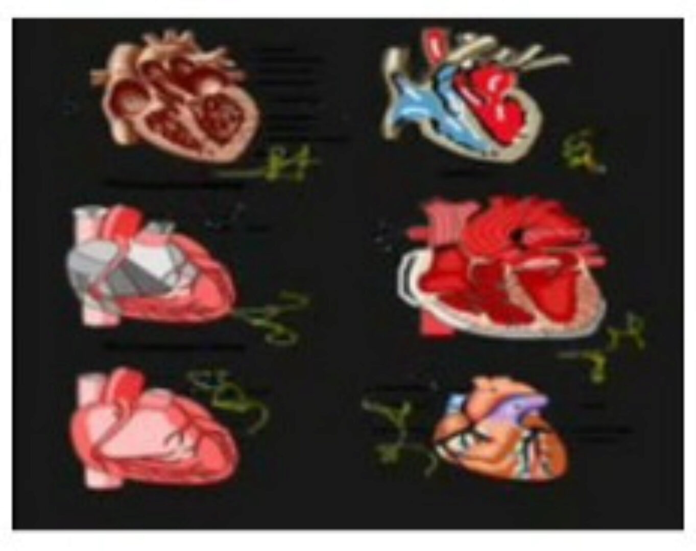 [Атлантида] Протекторы сердца - видеозаклинание