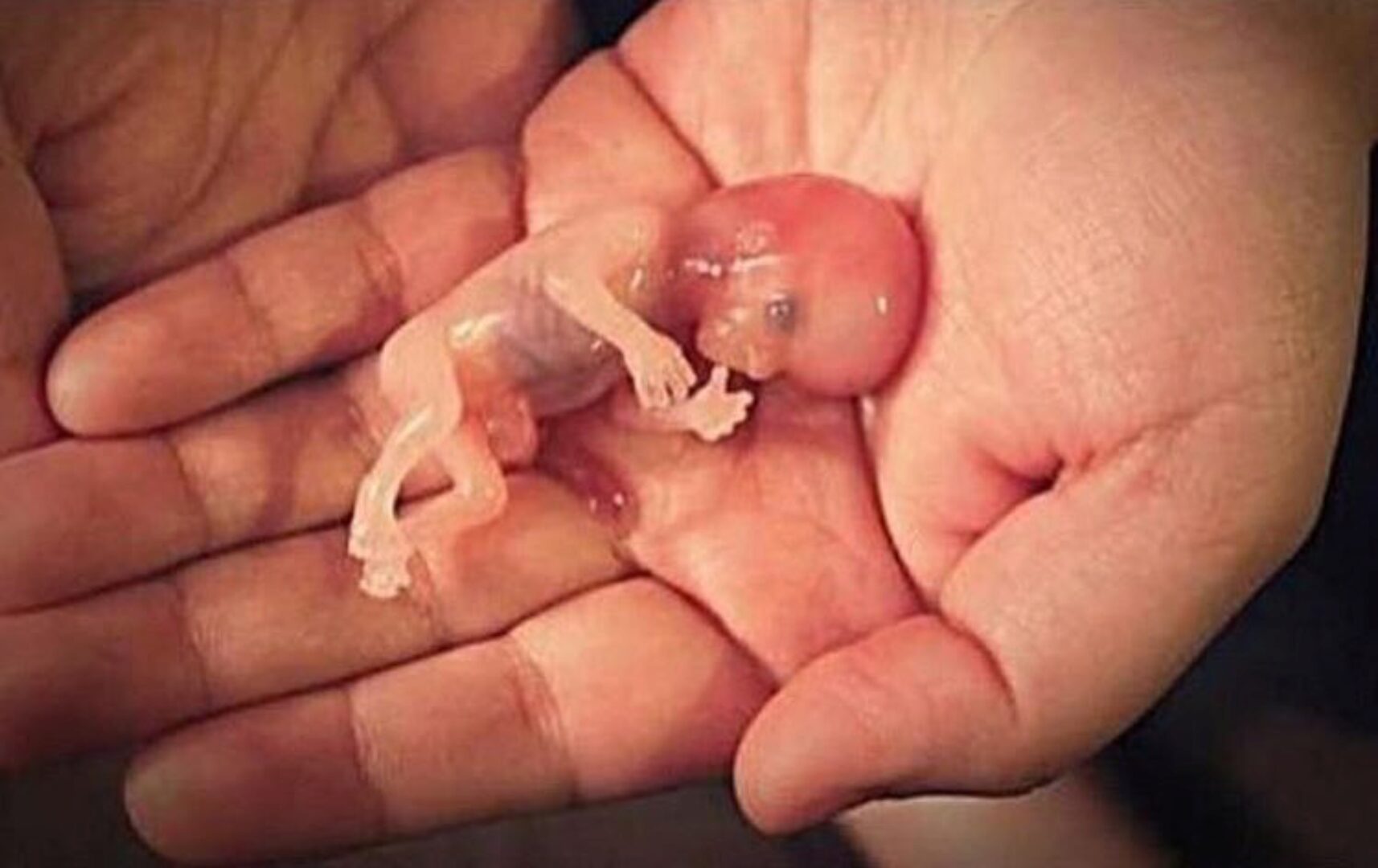 Семинар «Аборты, выкидыши, мертворождения - исправление последствий» (Светлана Соколова)