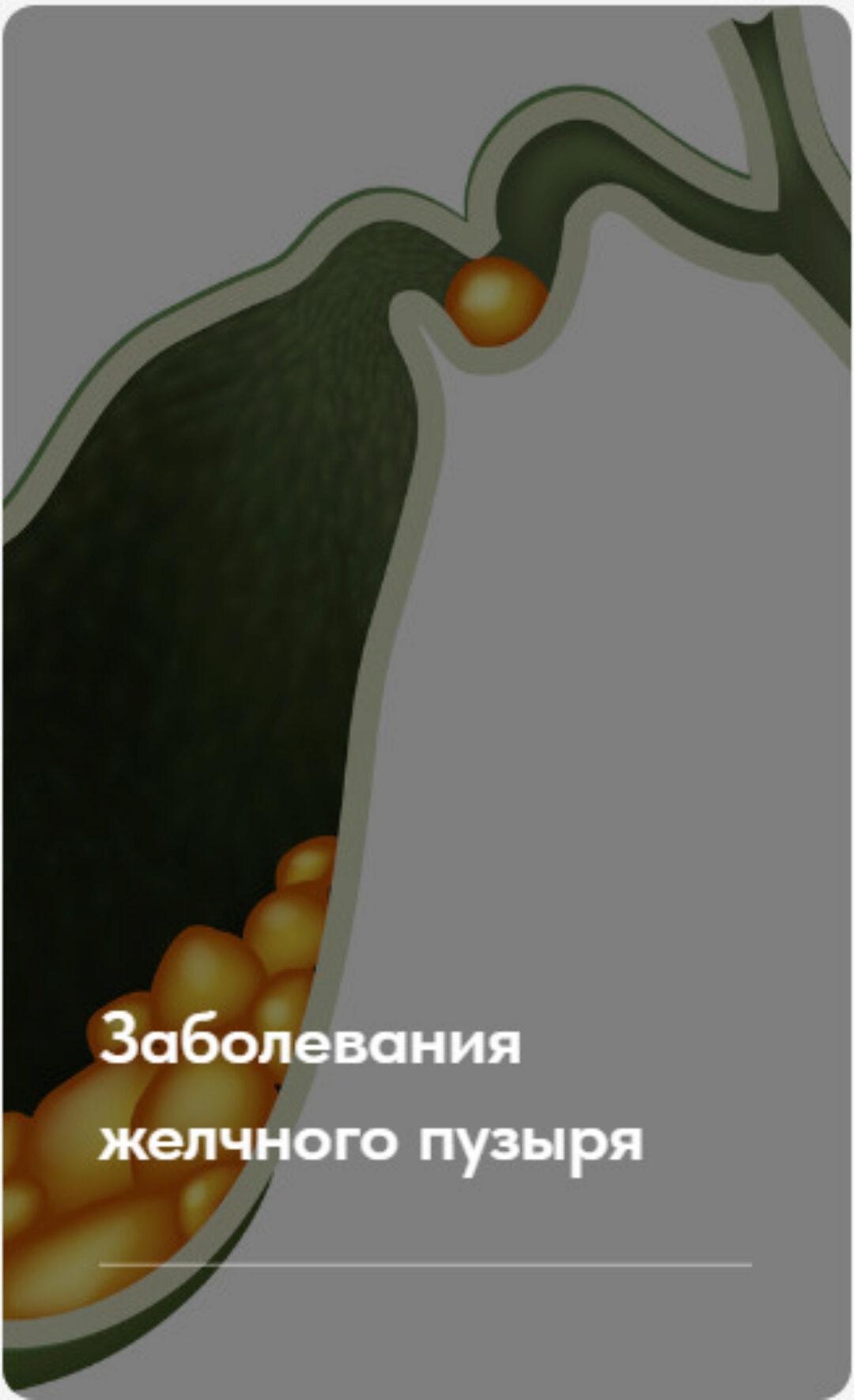 Заболевания желчного пузыря. Тариф Без обратной связи (Елена Ержанова)