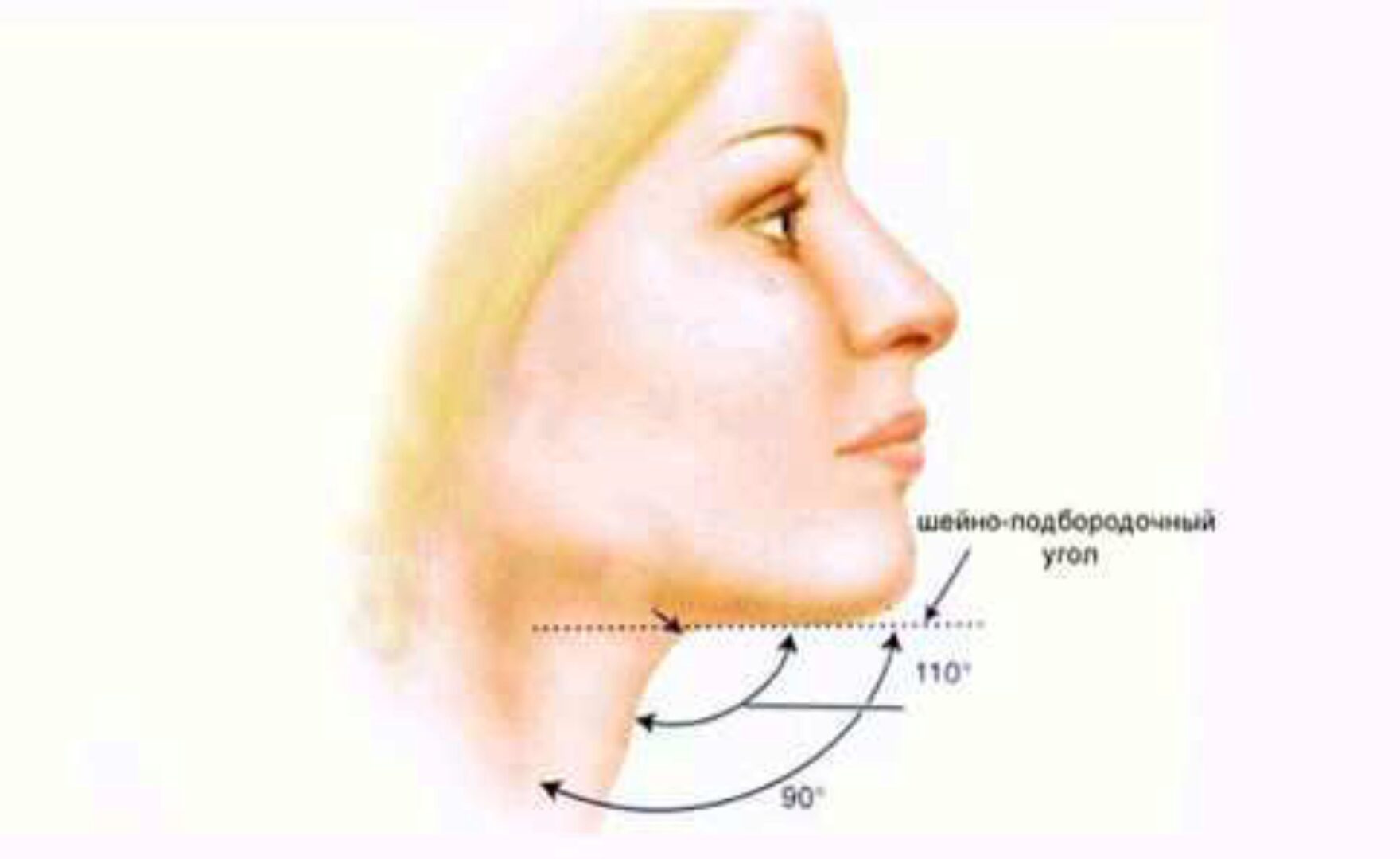 Самостоятельная коррекция овала лица и зоны подбородка (Татьяна Зенева)