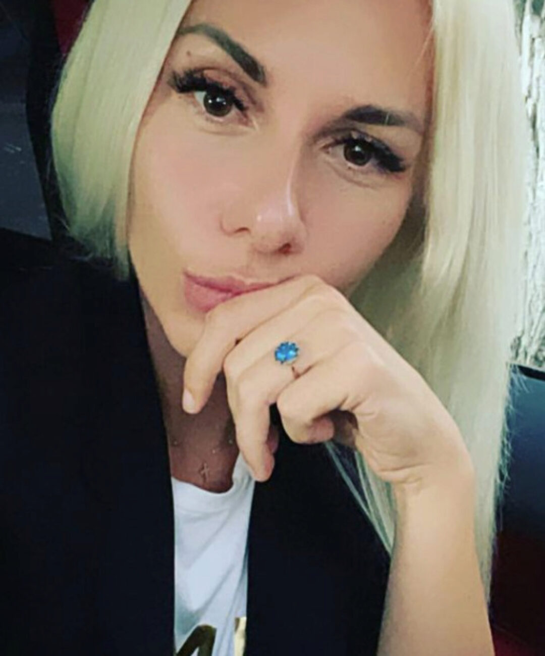 Методичка  Дисфункция надпочечников (Гала Гарбузова)