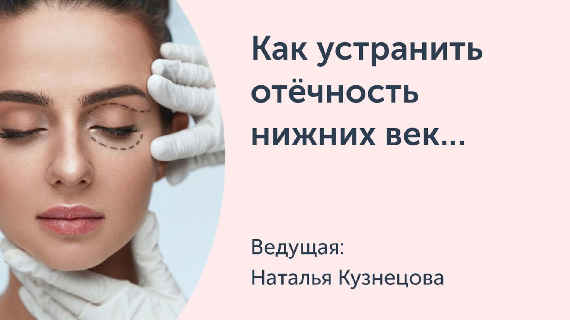 [Ревитоника] Как устранить отёчность нижних век, малярные мешки и сгладить борозды в орбитально-скуловой области (Наталья Кузнецова)