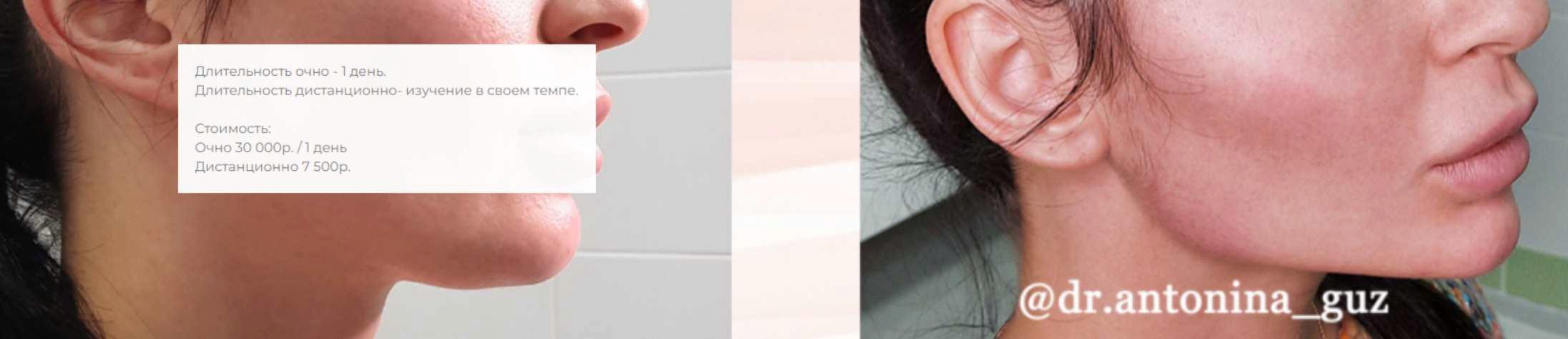 Профиль Джоли (Антонина Гуз)