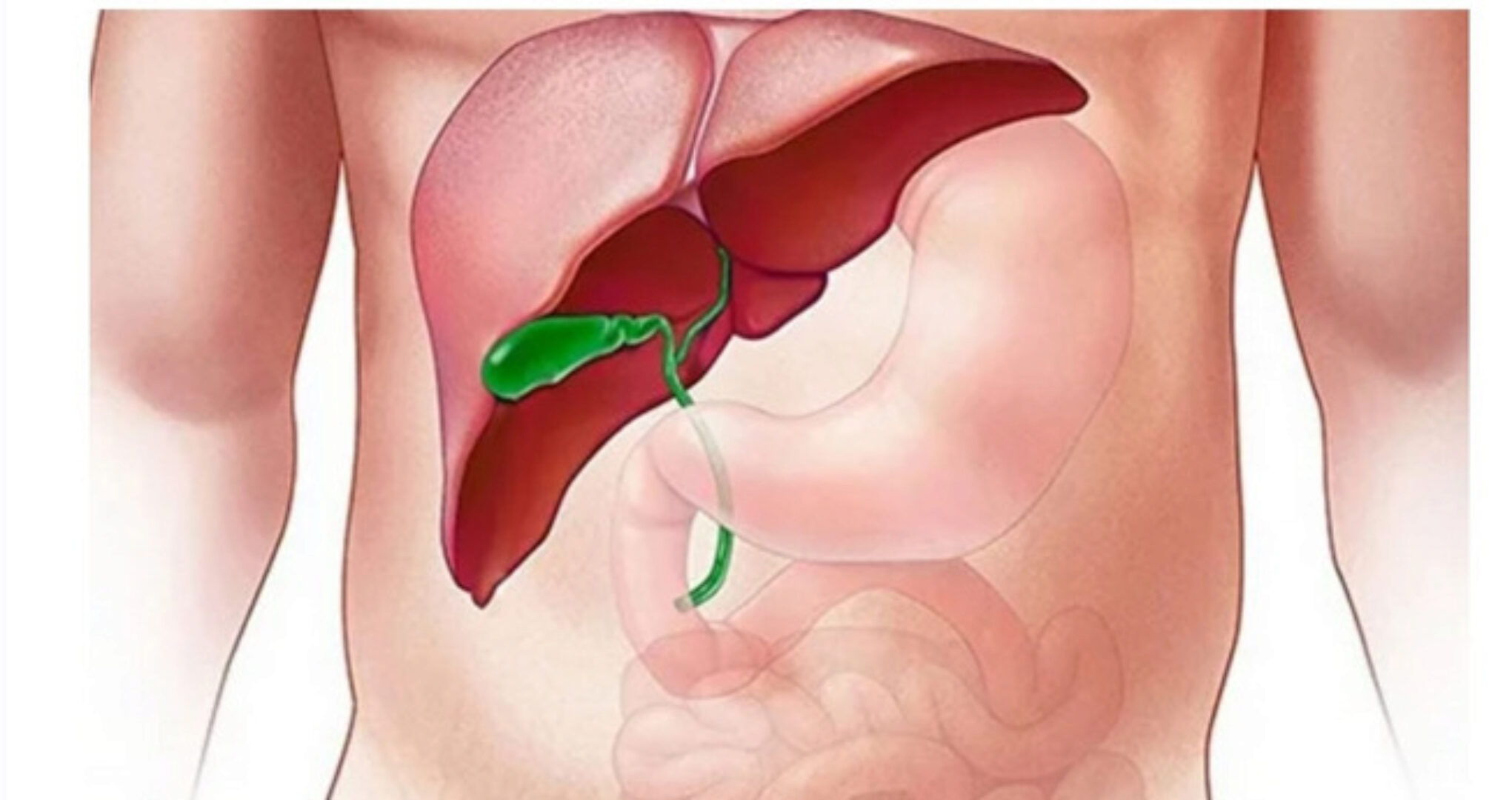 [Доктор Плесовских] Годовая программа лечения желчного при стойких запорах (Татьяна Плесовских)