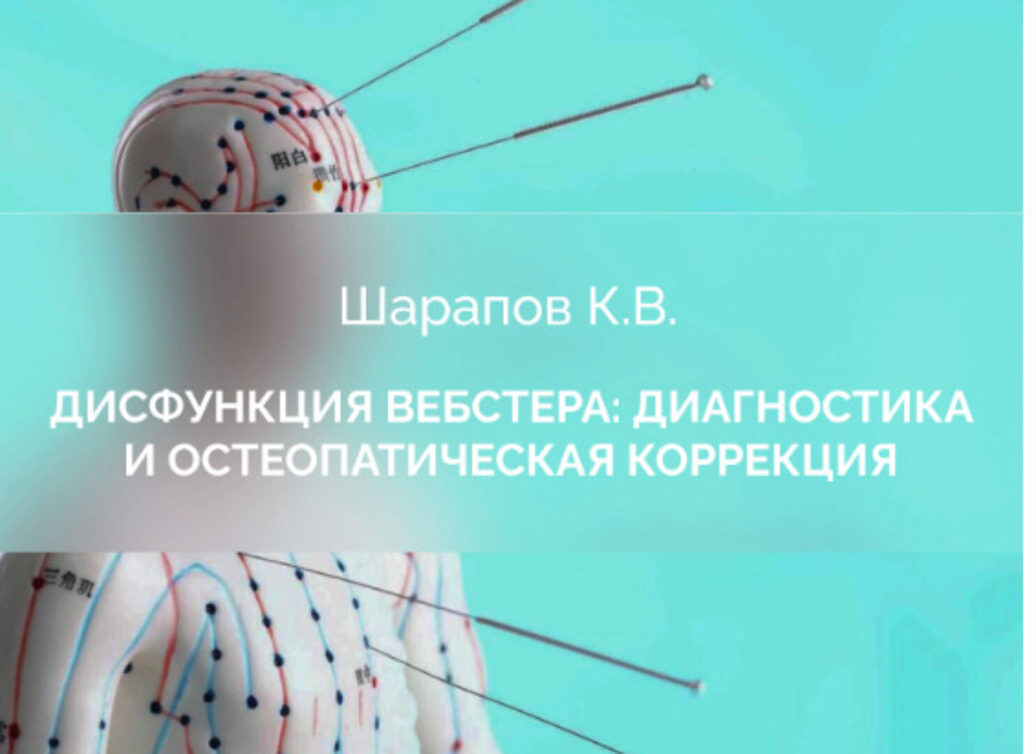 [cranio-acad] Дисфункция Вебстера: диагностика и остеопатическая коррекция (Константин Шарапов)