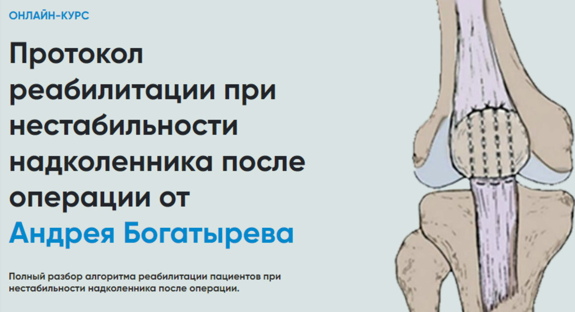 [Rehab Science] Протокол реабилитации при нестабильности надколенника после операции (Андрей Богатырев)