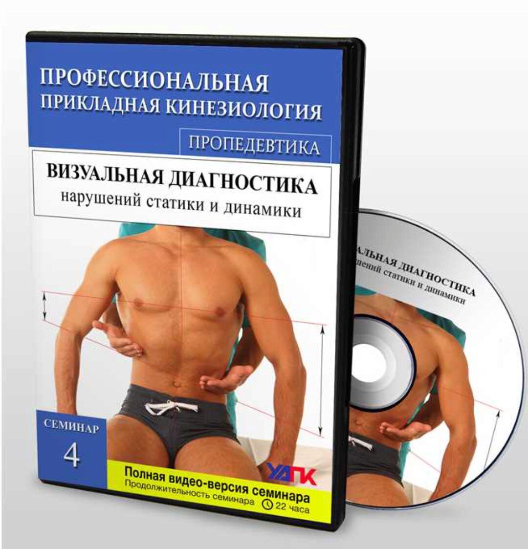 Визуальная диагностика нарушений статики и динамики. Семинар 4 (Глеб Кирдогло)