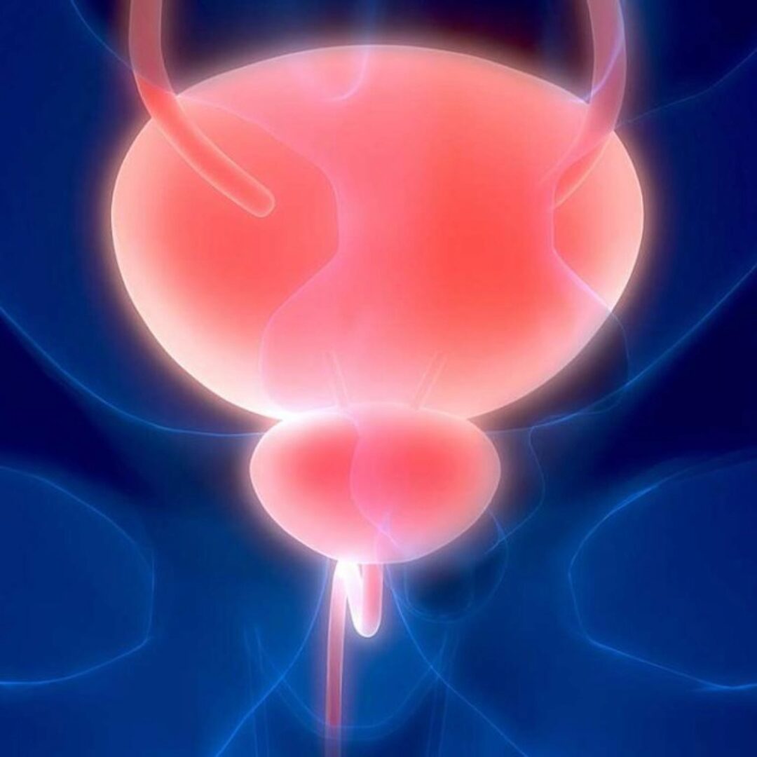 Фабула Мочевой пузырь 1.0 (Дмитрий Исаев, Александр Драгнев)