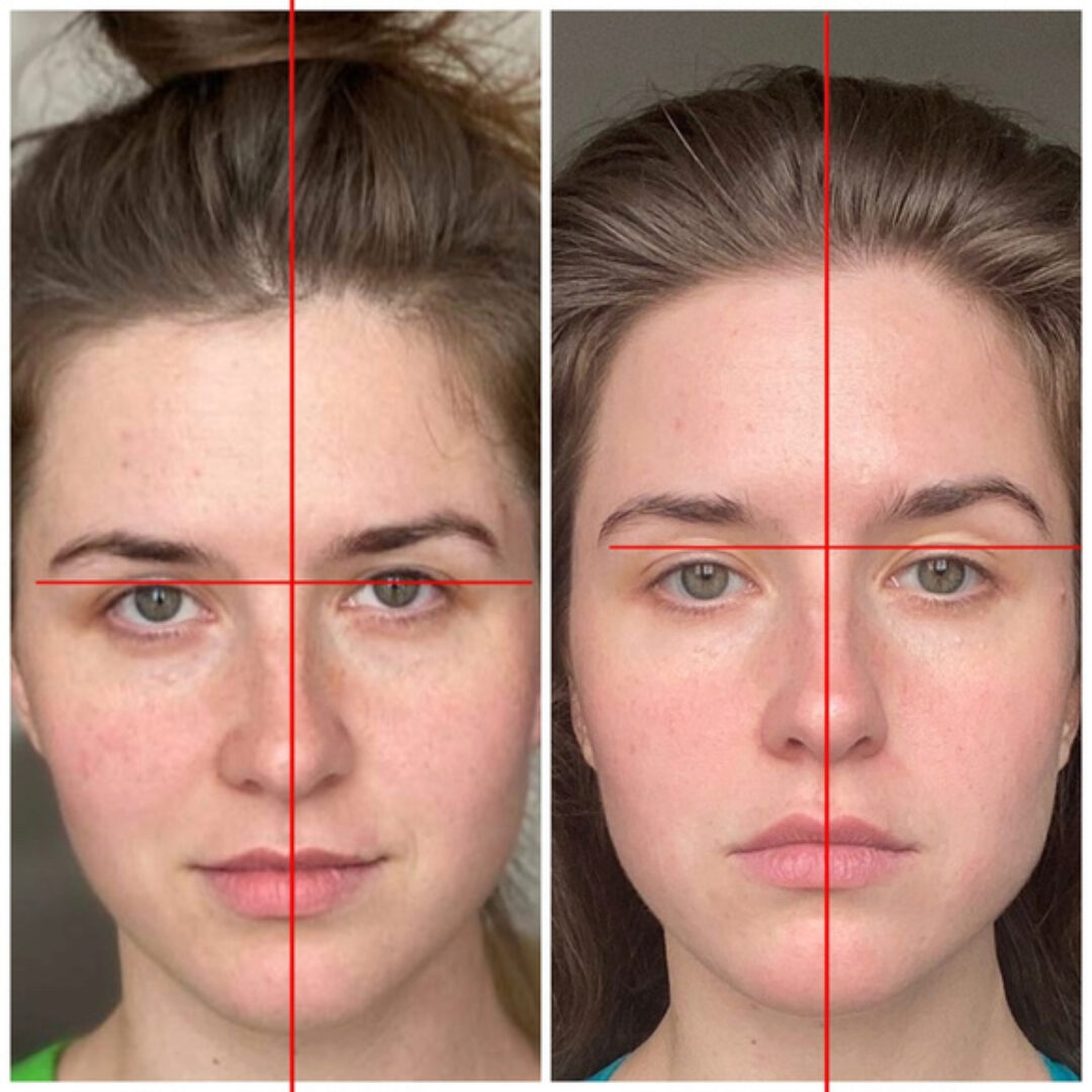 Самостоятельная коррекция черепа и челюсти (Кристина Андреева)