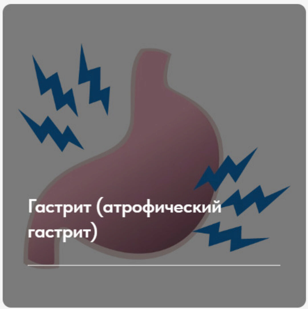 Лечебный протокол Гастрит. Атрофический гастрит. Тариф Без обратной связи (Елена Ержанова)