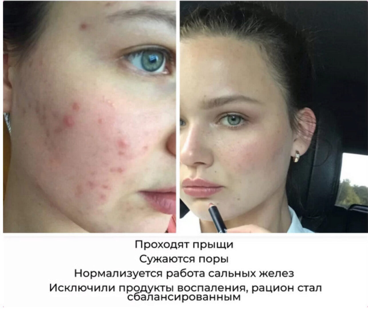 4 шага к красивой коже (Ксения Чёрная)