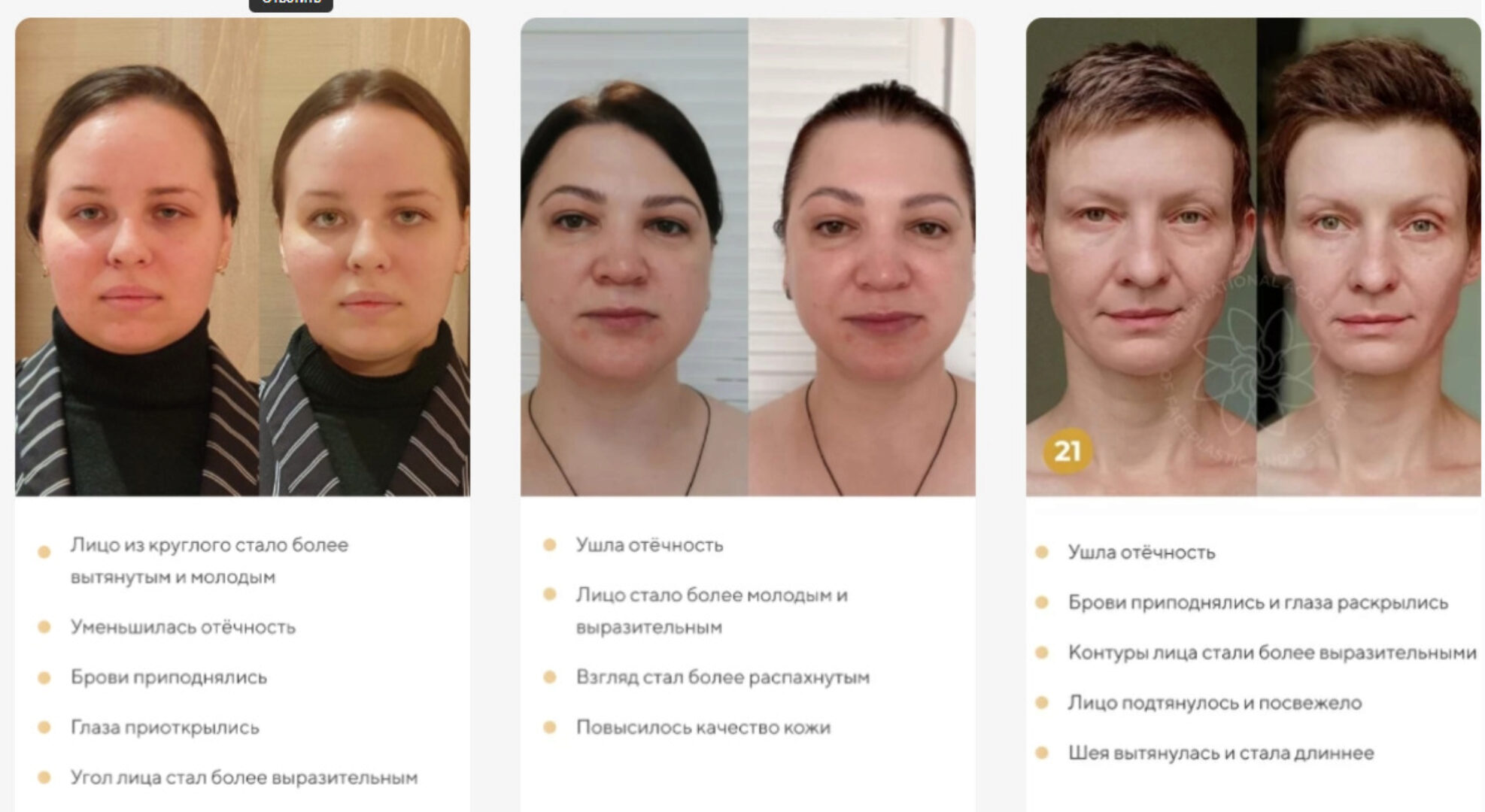 [Международная Академия фейспластики и остеопатии] Отекам Нет. Январь 2022 (Алесь Улищенко)