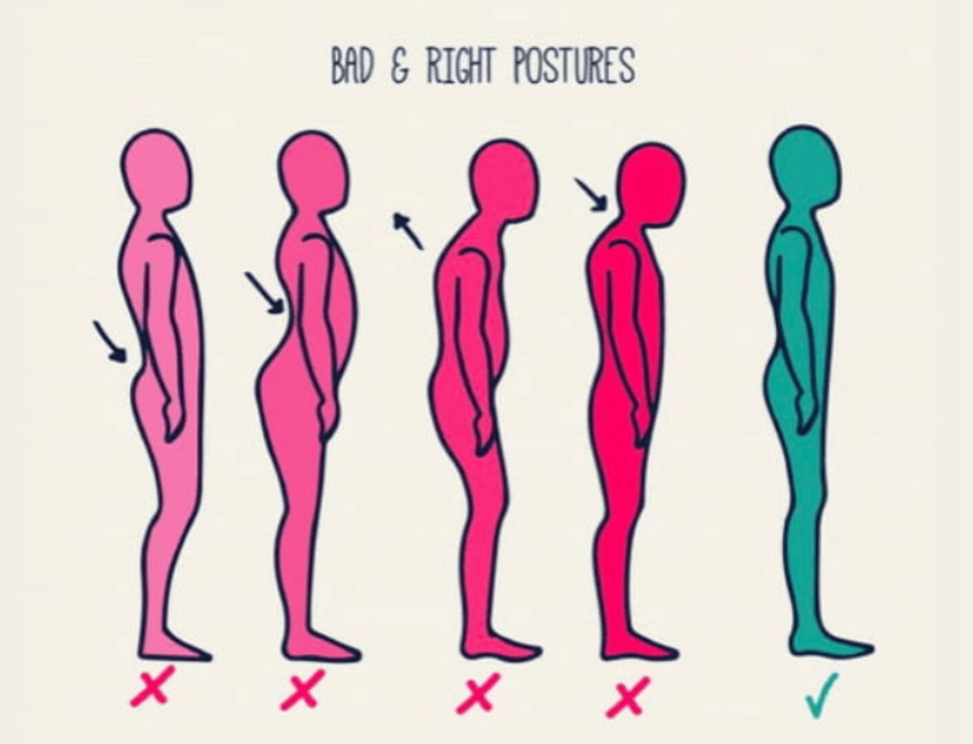 [wellcomclub] LITE Дистанционный курс «Тренировка при нарушениях осанки» (Эльмира Хабибуллина)