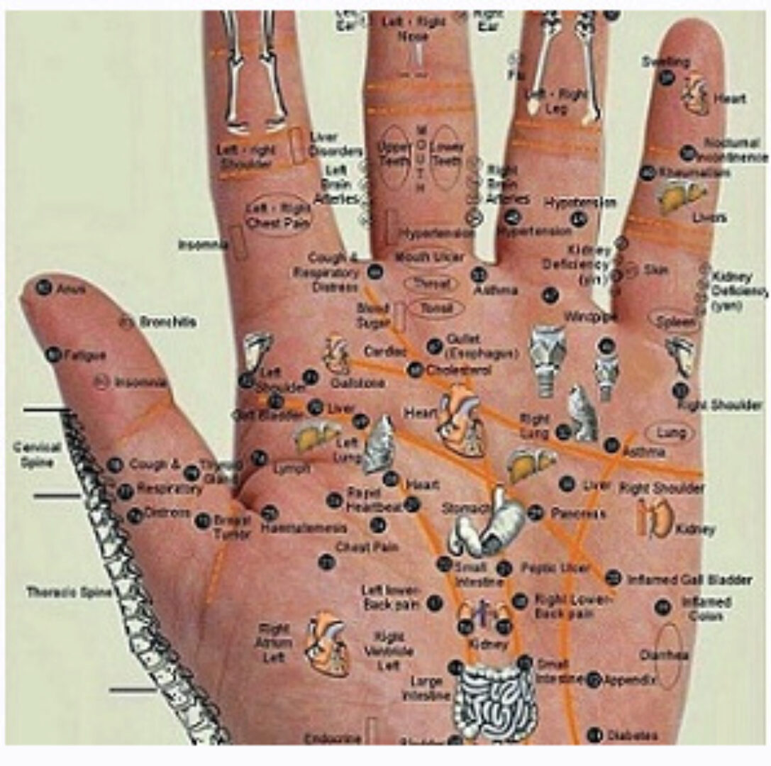 Вегетососудистая дистония (Ван Вэй)