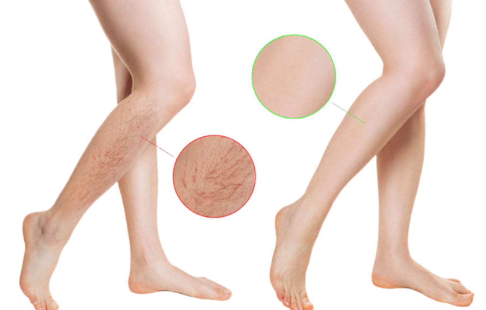 Секреты здоровых ног. Пакет «Минимум» (Александра Бонина)