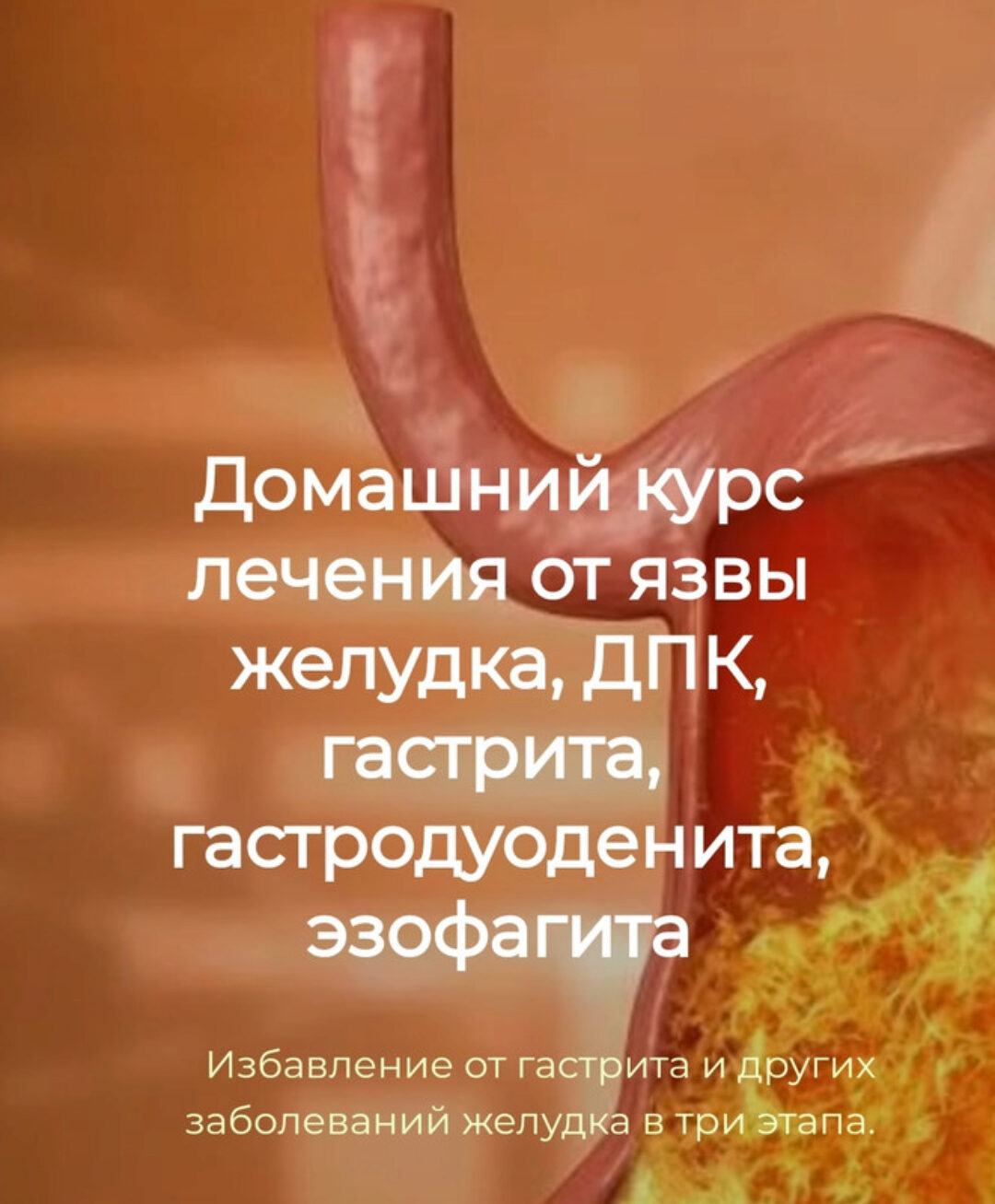 Детокс Кафа. Домашний курс лечения от язвы желудка, ДПК, гастрита,  гастродуоденита, эзофагита (Игорь Кауфман)