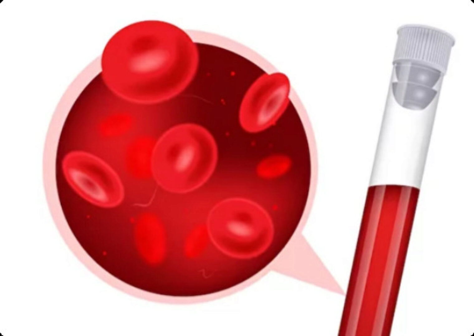 Чтение анализов. Анализ крови (Григорий Крутов)