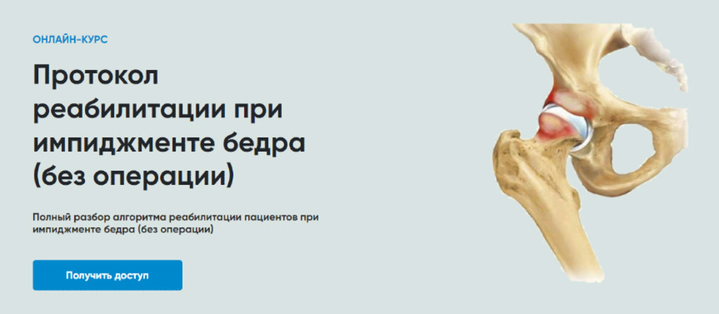 [Rehab Science] Протокол реабилитации при импиджменте бедра (без операции) (Андрей Богатырев)
