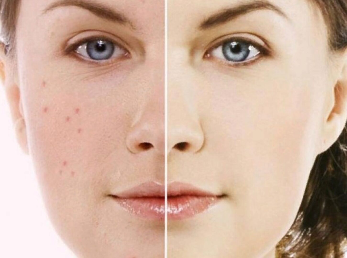 [Alhimik School] Жирная кожа (Наталия Ткаченко)