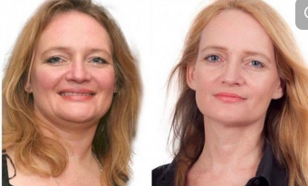 [irina_zayats] Компенсация гипотиреоза (Ирина Заяц)